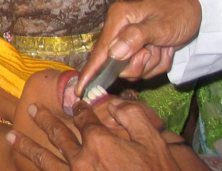 CEREMONIE DE LIMAGE DE DENTS 6